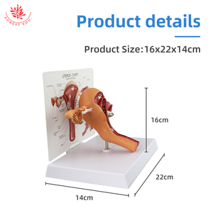 Modello utero organi riproduttivi femminili anatomia struttura patologica educazione anatomica - Product Image 3