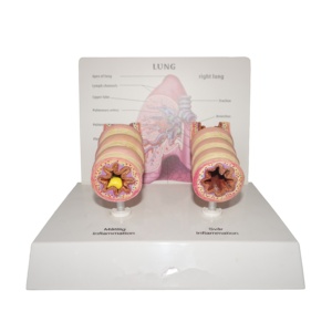 Modelo de Anatomía de Vías Respiratorias asmáticas humanas y vías respiratorias normales - Product Image 1