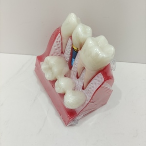 معدات تدريس تشريحية للعلوم الطبية تمرين محاكاة الأسنان عن طريق الفم نموذج زرع الأسنان البشري لدراسة الطلاب - Product Image 5