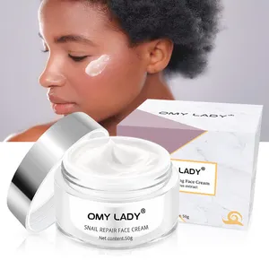 Balala Omy Lady Acne Puistje Verwijderen Cream Gezicht Anti Acne Whitening Cream Voor Gloeiende Huid