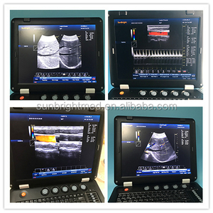 Equipo de Ultrasonido Portátil para el Corazón y Vascular Humano, Máquina de Ecografía Doppler Color CW - Product Image 4