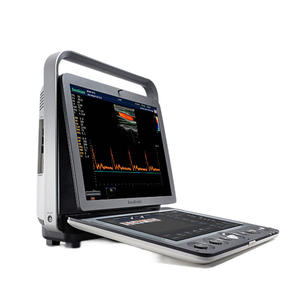 Sonoscape S9V Reusable Intelligent Veterinary <b>Ultrasound</b> Platform with Streamlined Diagnostic Workflow - Product Image 3