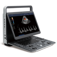 Ecógrafo Doppler Color Portátil SonoScape E2 E2V con un Transductor para Clínica Veterinaria y Hospital