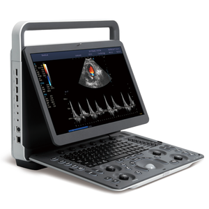 Appareil d'échographie portable Doppler couleur SonoScape E2V avec un transducteur pour clinique vétérinaire et hôpital - Product Image 5