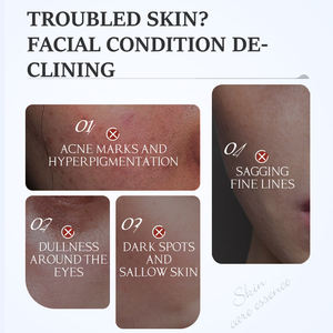 Kormesic 30 מ "ל הסיטונאי סרום פנים לחות ניקוטינאמיד הלבנה נגד אקנה פפטיד פאנטי קמטים קמט - Product Image 2