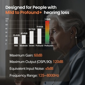 Audífonos Intraauriculares Color Beige 2025, 16/24/32 Canales, Resistentes al Agua, con Ajuste Remoto por Aplicación, para Personas Mayores - Product Image 4