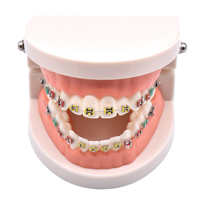 Modelo Dental Portátil de PVC para Enseñanza de Ortodoncia con Aparatos Ortodóncicos - Product Image 6
