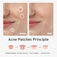 Éliminez l'acné du visage avec 40 patchs anti-acné en forme d'étoile, contenant de l'extrait de Centella Asiatica et de l'huile d'arbre à thé