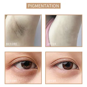 Sobrio pelle mimetica inchiostro tono della pelle Make Up pigmenti del tatuaggio smagliatura mimetizzabile pigmenti