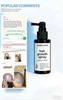 Spray de croissance capillaire à l'huile de romarin naturelle et à l'eau de riz OEM, tonique capillaire pour une repousse rapide, formule sûre et efficace contre la perte de cheveux