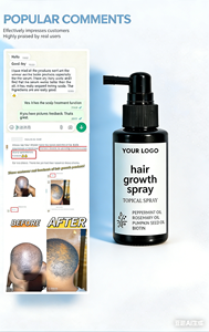 Spray OEM Naturale per la Crescita dei <span class=keywords><strong>Capelli</strong></span> con Olio di Rosmarino e Acqua di Riso, Tonico per <span class=keywords><strong>Capelli</strong></span> per Rapida Ricrescita, Formula Sicura ed Efficace <span class=keywords><strong>Contro</strong></span> la <span class=keywords><strong>Caduta</strong></span> dei <span class=keywords><strong>Capelli</strong></span> - Product Image 6