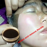 Masque facial peel-off anti-taches pigmentaires et points noirs pour le nez et la zone T, à l'extrait de ginseng coréen, pour éclaircir la peau