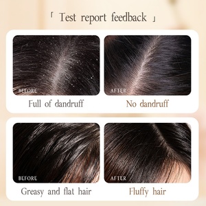 OEM Shampooing antipelliculaire au sélénium disulfure 300ml Parfum doux et durable Rafraîchissant Anti-huile Anti-pelliculaire - Product Image 6