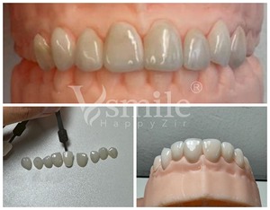 Vsmile HappyZir HT presinterizzato blocco di <span class=keywords><strong>Zirconia</strong></span> per sistema di fresatura Cad Cam Z-95 16MM - Product Image 4