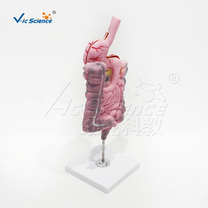 Modelo <span class=keywords><strong>de</strong></span> Simulación <span class=keywords><strong>de</strong></span> Enfermedades del Sistema Digestivo - Modelo Anatómico <span class=keywords><strong>de</strong></span> Ciencias Médicas para Entrenamiento en Escuelas <span class=keywords><strong>de</strong></span> Medicina Vic Science Model - Product Image 2
