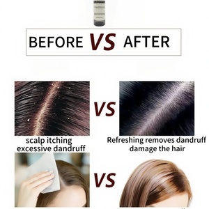 Champú orgánico anticaspa, limpia profundamente, alivia la picazón, elimina la caspa, calma el cuero cabelludo, fortalece las hebras del <span class=keywords><strong>cabello</strong></span> - Product Image 4