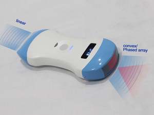 SY-AC51_CPL pemindai <span class=keywords><strong>ultrasound</strong></span> nirkabel, pemindai <span class=keywords><strong>ultrasound</strong></span> saku cembung/linear/phased array 3 dalam 1 - Product Image 3