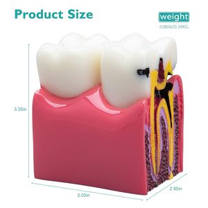 Modelo Educativo Dental: Comparación Bilateral de Caries, Modelo de Demostración Transversal 6 Veces Ampliada, Accesorios para la Enseñanza de la Decidencia Dental - Product Image 4