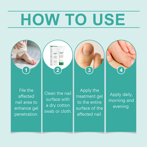 Gel de soin des <span class=keywords><strong>ongles</strong></span> 20g pour la réparation des <span class=keywords><strong>ongles</strong></span> abîmés, la prévention des champignons et la promotion de la croissance des <span class=keywords><strong>ongles</strong></span>, sans logo - Product Image 6