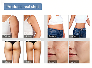 Home Use 6 in 1 Multifunctional Beauty Device for Body Contouring and Skin Tightening 3-7 Days Fast Delivery - Product Image 6