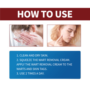 Crema de Tratamiento para Verrugas con Veneno de Abeja Ximonth, Suaviza la Piel, Reduce las Manchas Oscuras y los Pápulas Faciales, Limpia y Trata Suavemente las Verrugas - Product Image 6