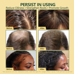 Shampoo réparateur pour la croissance des cheveux à base de romarin, de jojoba et d'arbre à thé biologique naturel personnalisé, 500 ml, pour le contrôle du sébum et les soins capillaires - Product Image 5