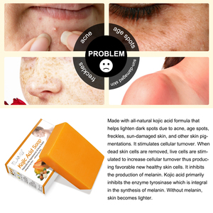 Làm Sáng Kojic Axit Xà Phòng Ban Đầu Làm Trắng Da Xà Phòng Làm Bằng Tay Kojic Axit Xà Phòng Cho Làm Giảm Sự Xuất hiện của Mụn Trứng Cá Sẹo - Product Image 2