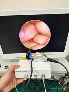 Medical Endoscopic Camera System FHD 1080P Portable <strong>Endoscope</strong> Camera Laparoscope for ENT <strong>endoscope</strong> - Product Image 6