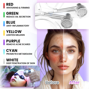 Nuovo Design Seaheart HydraMaster Aquafacial Dermabrasion 9 in <span class=keywords><strong>1</strong></span> <span class=keywords><strong>Macchina</strong></span> per Trattamenti di Bellezza Hydra per Pulizia Profonda della Pelle - Product Image 4