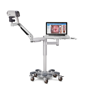 Produsen Peralatan Medis EDAN C6HD C6HDA Kolposkop Video HD Asli - Product Image 5