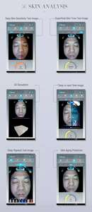 เครื่องวิเคราะห์ผิวหน้ายอดนิยม เครื่องตรวจจับสภาพผิวด้วย AI เครื่องวิเคราะห์ความชุ่มชื้นของเส้นใยไฟโบรบลาสต์ - Product Image 5