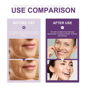 Essence faciale au rétinol hydratante, éclaircissante, soin de la peau, anti-rides, huile essentielle - Product Image 3