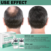 Exo Zome Booster Ampoule Follicules pileux pour la croissance des cheveux Soins du cuir chevelu Cellules souches du cuir chevelu Soins du cuir chevelu Vieillissement du cuir chevelu Meilleur sérum de repousse des cheveux B