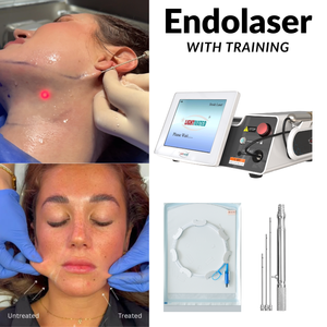 Láser de Diodo Endolaser 980nm 1470nm para Endolifting, Liposucción con <span class=keywords><strong>Jeringa</strong></span>, Cirugía Plástica, Lifting Facial y Rejuvenecimiento de la Piel - Product Image 1