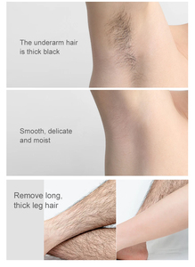 Crème dépilatoire permanente OEM Ecrin, lisse et indolore, spray dépilatoire - Product Image 5