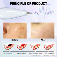 Stylo à plasma coréen pour lifting facial, élimination des taches et des grains de beauté, lifting des paupières, élimination des taches de rousseur, appareil de nettoyage en profondeur