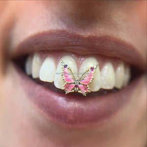 Rose émail papillon Grillz filles visage ouvert femmes mignonnes <span class=keywords><strong>haut</strong></span> <span class=keywords><strong>avant</strong></span> <span class=keywords><strong>dent</strong></span> rose Moissanite diamant S925 argent or dents Grillz - Product Image 4