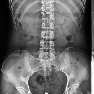 سعر المصنع 200ma 500mA 630mA الطبية DR X راي نظام التصوير الشعاعي الرقمي 20KW 50KW 65KW جهاز الأشعة السينية MSLHX04 - Product Image 6