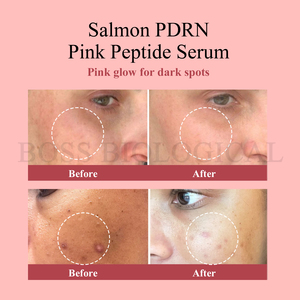 Sérum PDRN Premium OEM Anti-Âge, Stimulant de Collagène, Hydratant, Soin de la Peau pour un Éclat Radieux - Product Image 3