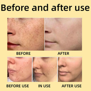 Etiqueta privada Anti-Microbiano Jabón de hierbas naturales Cara Cuerpo Baño Eliminador de ácaros Jabón de azufre - Product Image 5