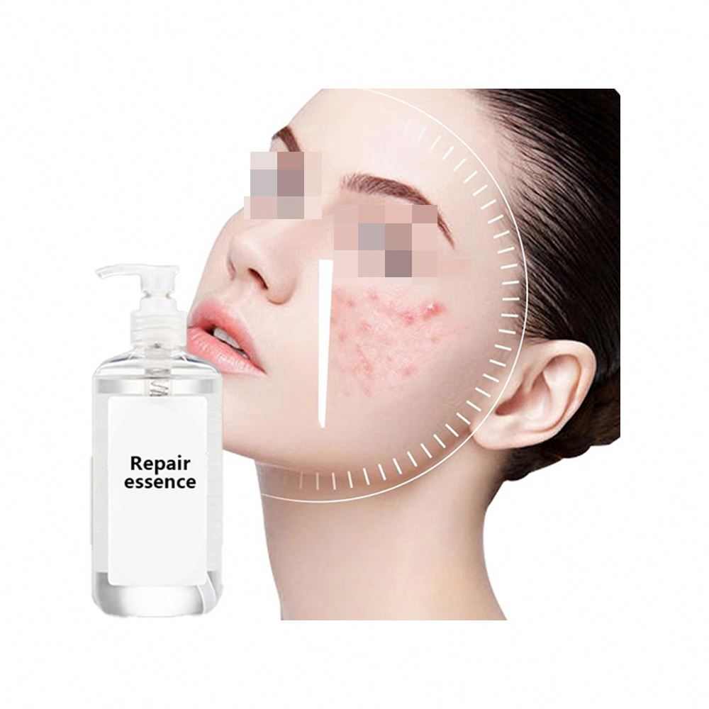 OEM Serum Wajah Anti Penuaan, Vitamin C Fase Ganda Essence Peptida Oksigen Sel Stem Apple Perbaikan Serum Wajah Anti Penuaan Bahan Banyak Dijual Oleh Kg
