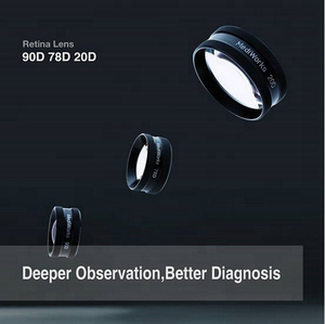 90D <span class=keywords><strong>Fundus</strong></span> kontakt Lens Retina Lens yarık lamba-oftalmik asferik Lens yarık lamba - Product Image 5