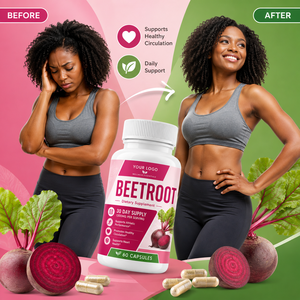 Private Label Natural Plant <b>Supplements</b> Wellness Support Athletic Performance Energy Formula Beetroot Capsules <b>Supplement</b> - Product Image 2