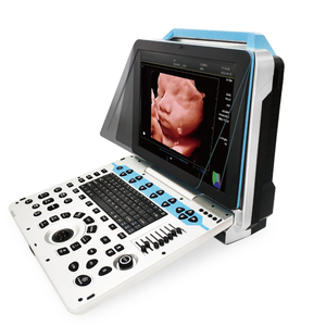 ROBIN RB-P30 Máquina Veterinaria Portátil <span class=keywords><strong>Doppler</strong></span> Color para Laptop con Pantalla LED de 15.6'', Diseño Ecológico, Larga Duración en Espera, Multi-Escena para Granja - Product Image 1