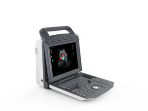 MSLCU45 - Ecógrafo Portátil 3D con Color para Uso Humano - Product Image 6