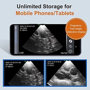 Appareil vétérinaire portable à ultrasons sans fil GOYOJO, sonde 5 MHz, équipement de diagnostic de gestation animale pour Android - Product Image 4