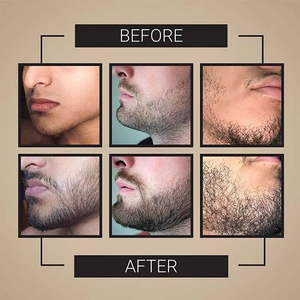 OEM /ODM <b>Collagen</b> Beard Growth Gummies 60 Count for Men Natural Ingredients Promote Beard Hair Growth Support 2 Gummies Per - Product Image 5