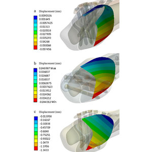 Implantes Ortopédicos Quirúrgicos Manuales de Titanio para Tibia Distal, con Bloqueo Intramedular Multidimensional, Eficaz para Traumatismos - Product Image 5