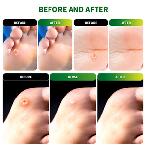 Sumifun Patchs anti-callosités de haute qualité en boîte, à l'acide salicylique et aux herbes chinoises, en tissu non tissé, 54 autocollants pour le soin <span class=keywords><strong>des</strong></span> pieds - Product Image 4