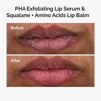 Soin des lèvres tendance, sérum exfoliant pour les lèvres avec PHA, avec étiquette privée